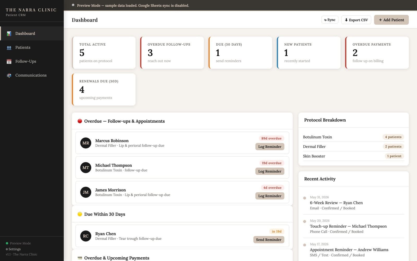 The Narra CRM dashboard: patient KPIs, an overdue follow-ups list, treatment-protocol breakdown, and recent activity, in Narra's taupe brand.
